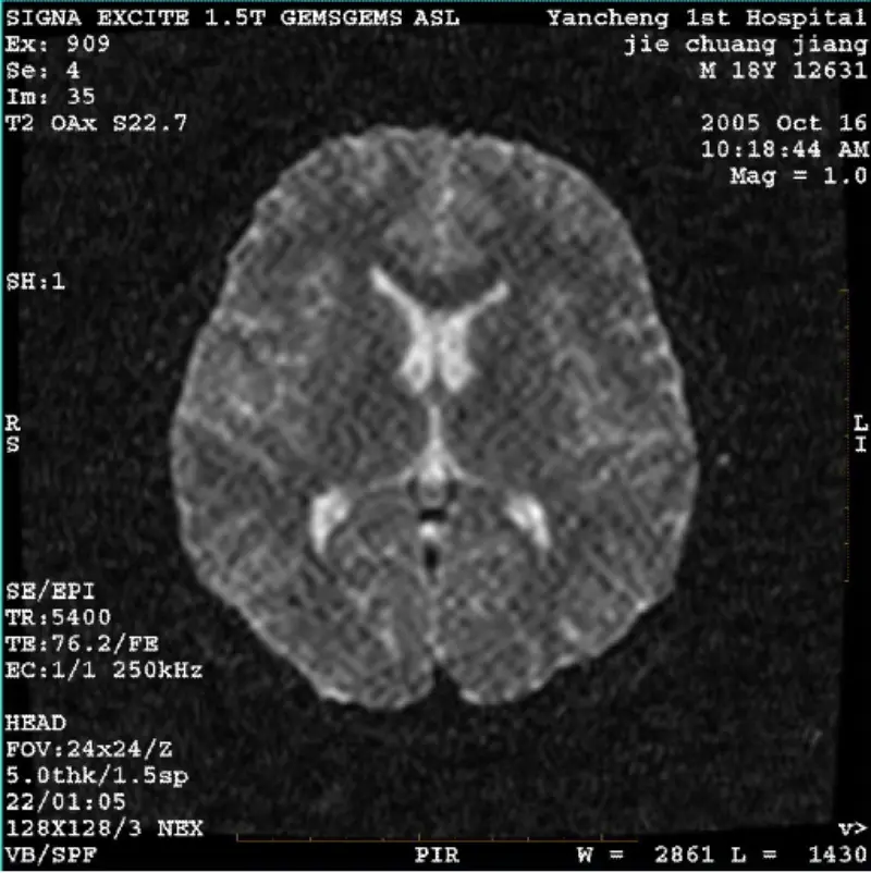 ARTEFAKT WI/Fiesta-Bild, weiße Pixel