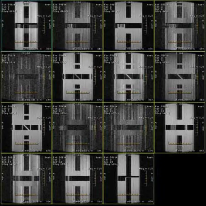 FSE- und GRE-Artefakt